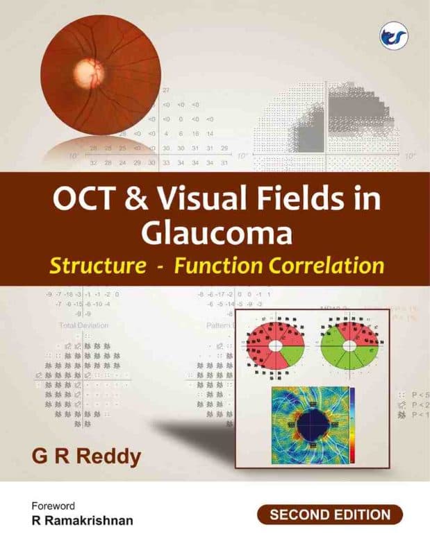 OCT& Visual Fields in Glaucoma Structure-Function Correlation