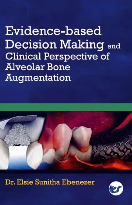 Evidence-Based Decision Making And Clinical Perspective Of Alveolar Bone Augmentation