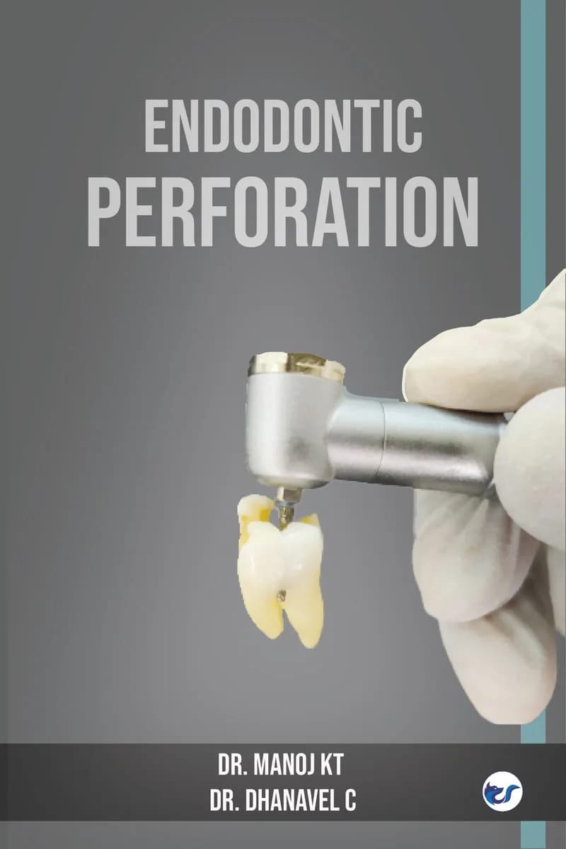 Endodontic Perforation