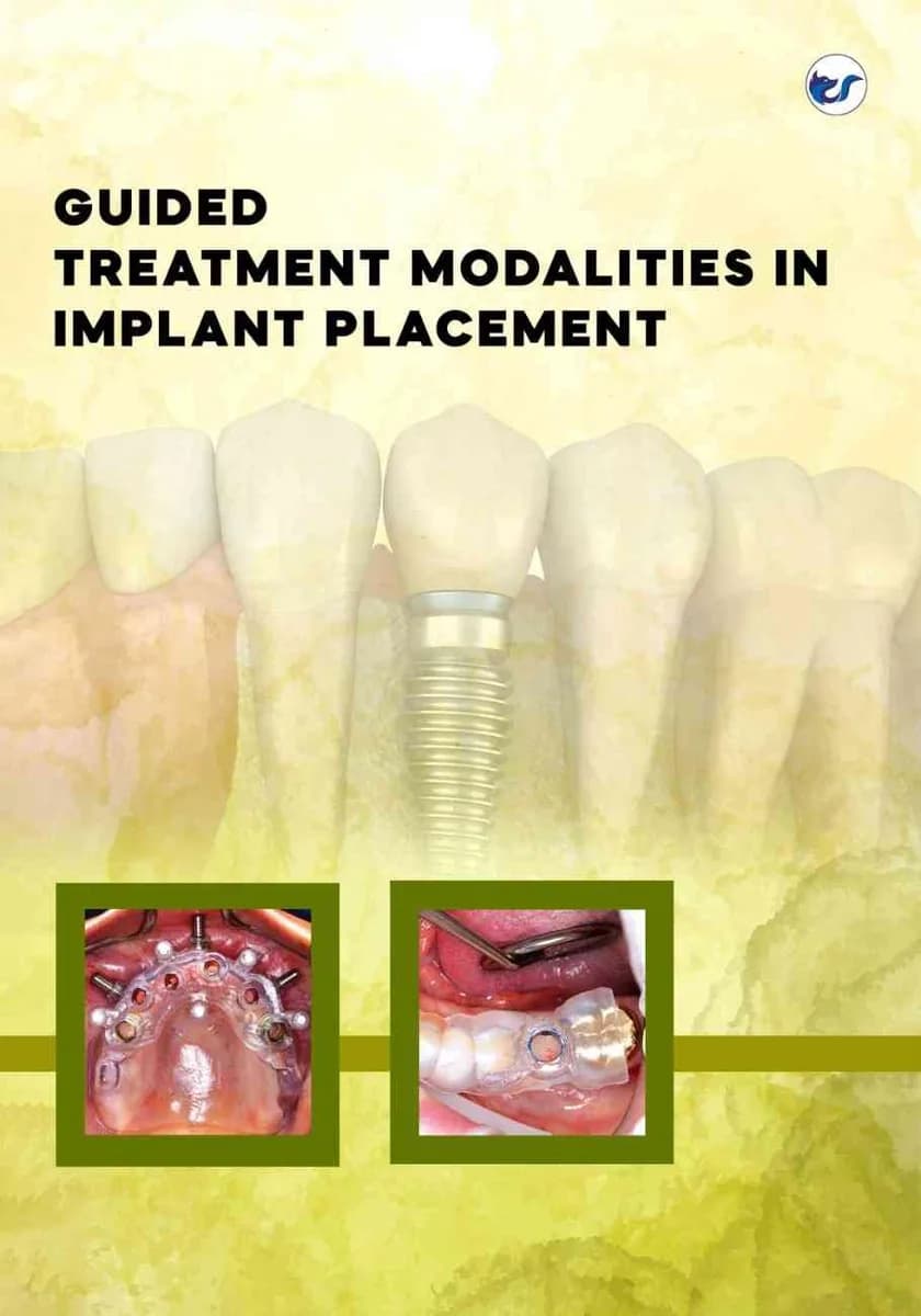 GUIDED TREATMENT MODALITIES IN IMPLANT PLACEMENT